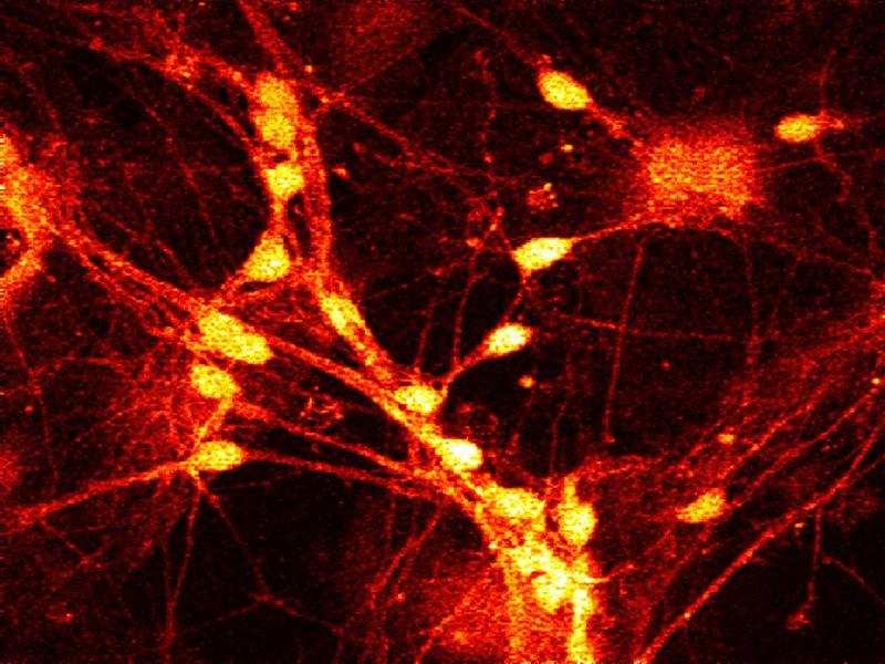 neuron fire.jpg (86819 bytes)