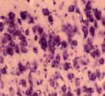 10x Photomicrograph Cat Forebrain