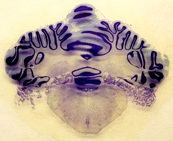 Cross-section of cat hindbrain