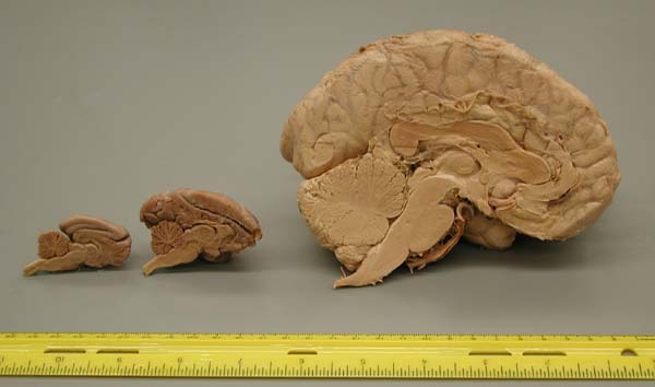 group of brains - midsagittal slice