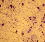 10x Photomicrograph Human Hindbrain