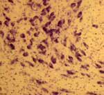 10x Photomicrograph Monkey Hindbrain