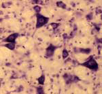 20x Photomicrograph Rat Hindbrain