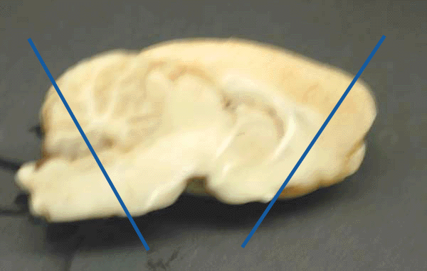 Midsagittal view of rat brain