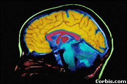 brain parts mri part 3 intro.jpg (10773 bytes)